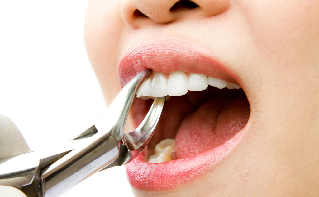 Сохранить зуб или удалить?