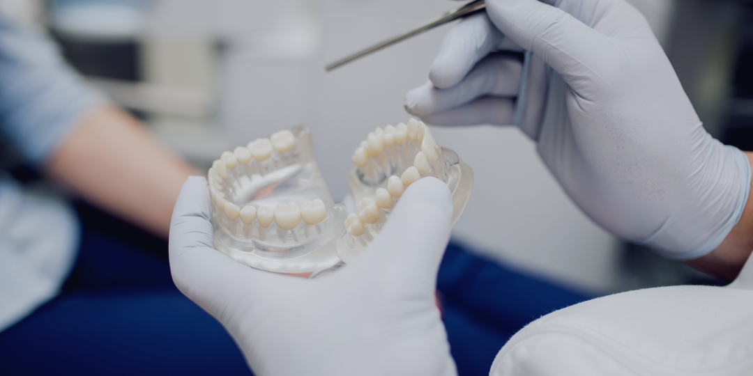 Как выбрать клинику для имплантации зубов в Астане