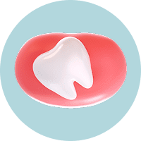 Если вам требуется лечение десен