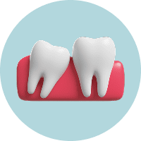 Если зуб сломан, выбит или вывихнут