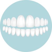 Если вы хотите новые зубы максимально быстро