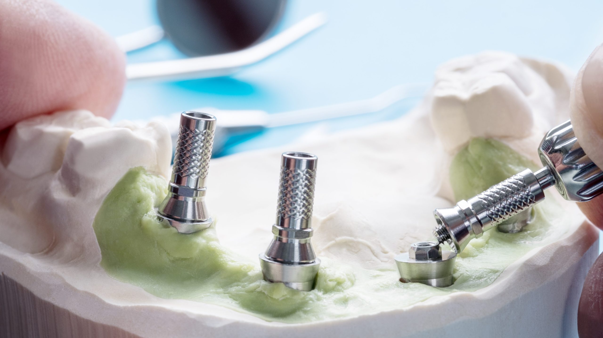 Dental implant temporary abutment