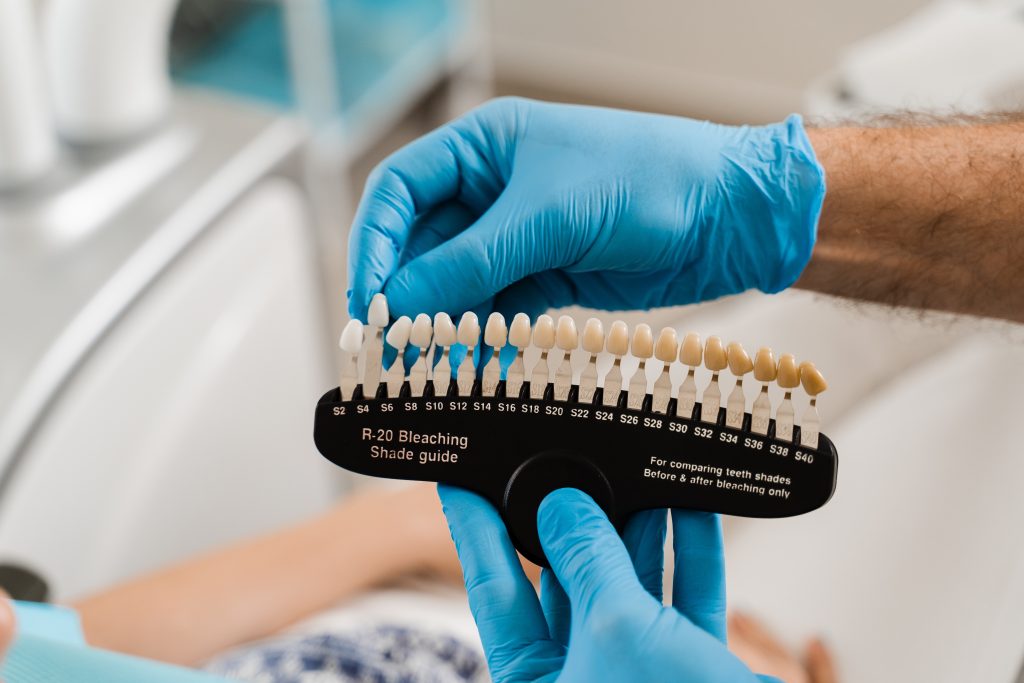 Teeth color shades guide close-up. Dentistry. Veneers or implants teeth color matching samples for tooth whitening for woman patient in dental clinic.