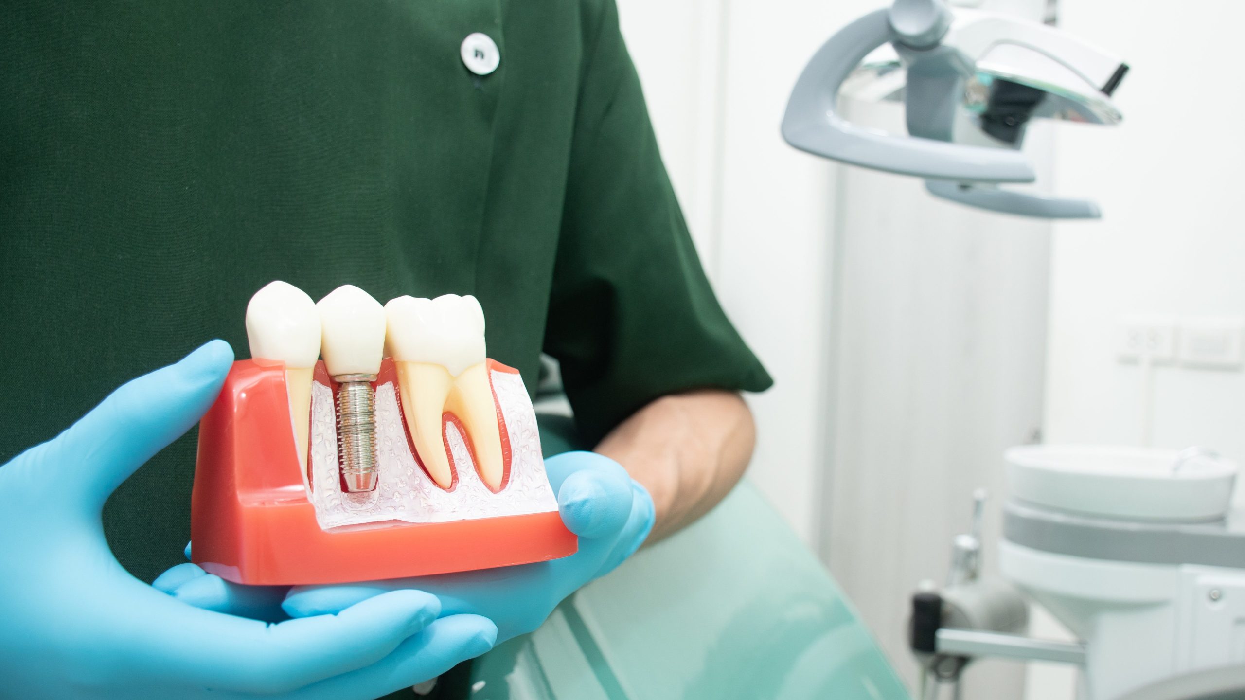 Male dentist carrying a sample of dental implants.