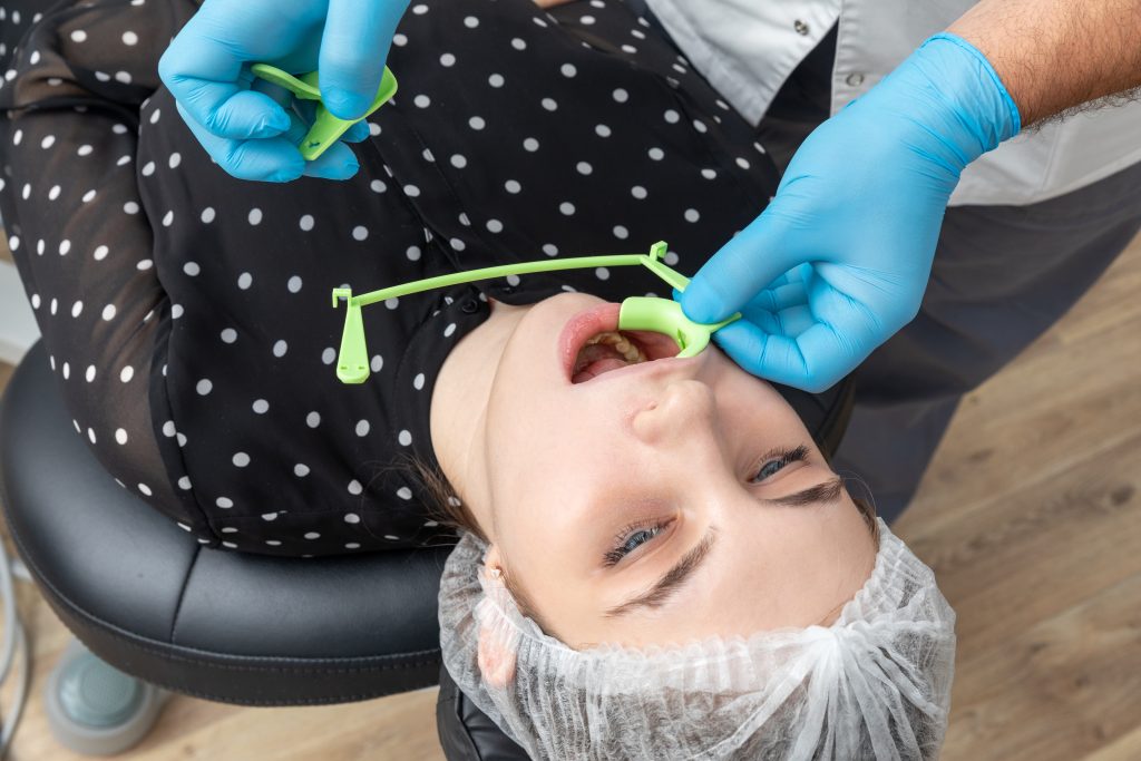 Dentist installing a patient cheek retractor in dentist office