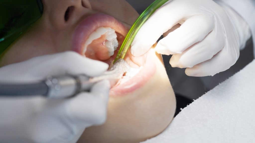 stomatologiya-astana-lechenie-010