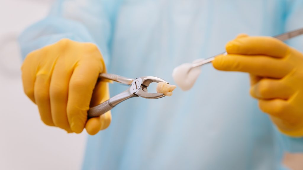 Close up of dentist extracting a tooth with sterile tools and gloves in a clinical setting