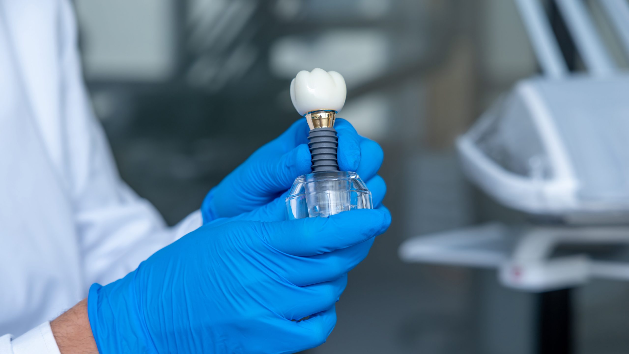 Unrecognizable doctor holding dental layout of upper veneers of teeth prothesis