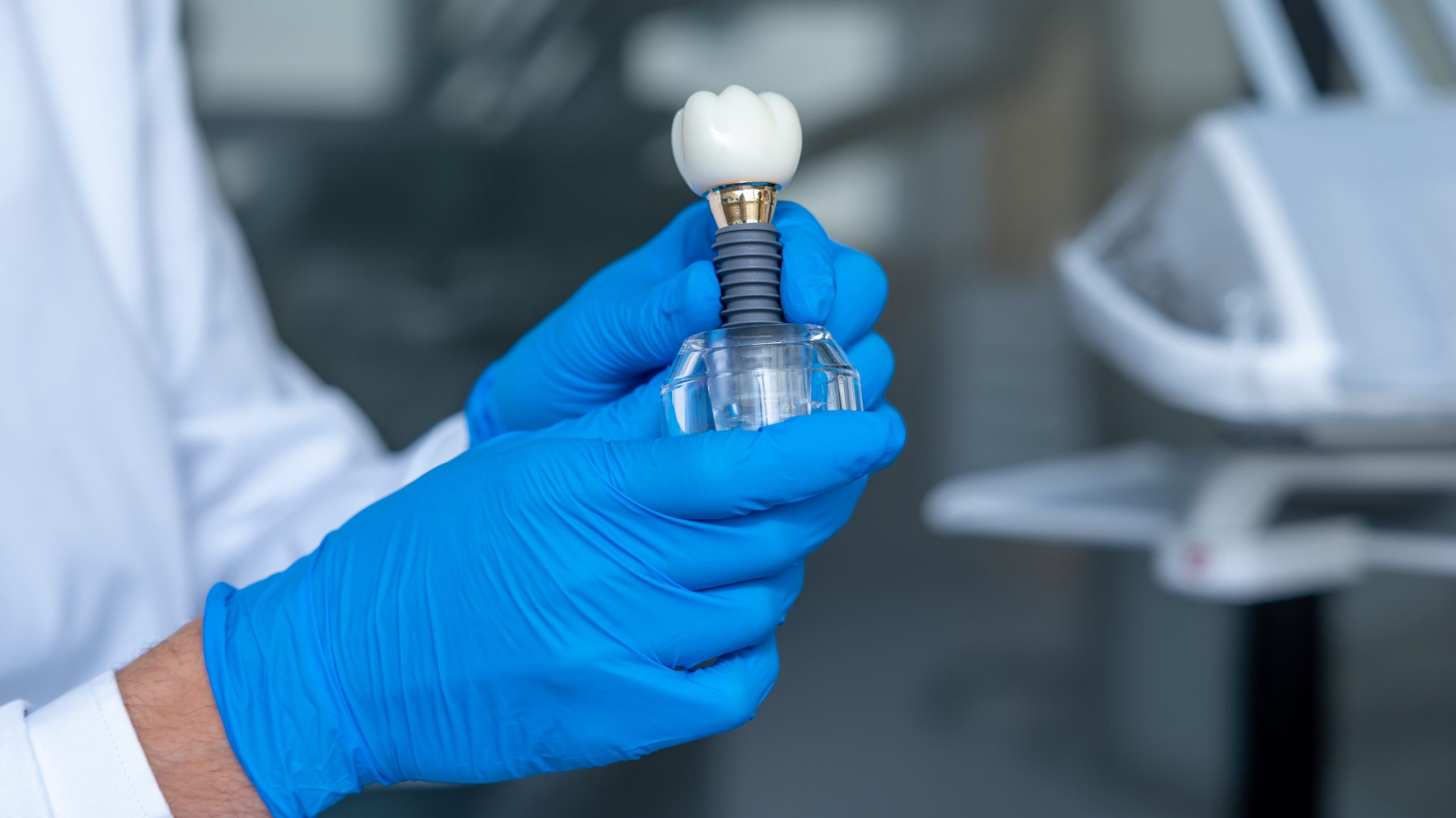 Unrecognizable doctor holding dental layout of upper veneers of teeth prothesis