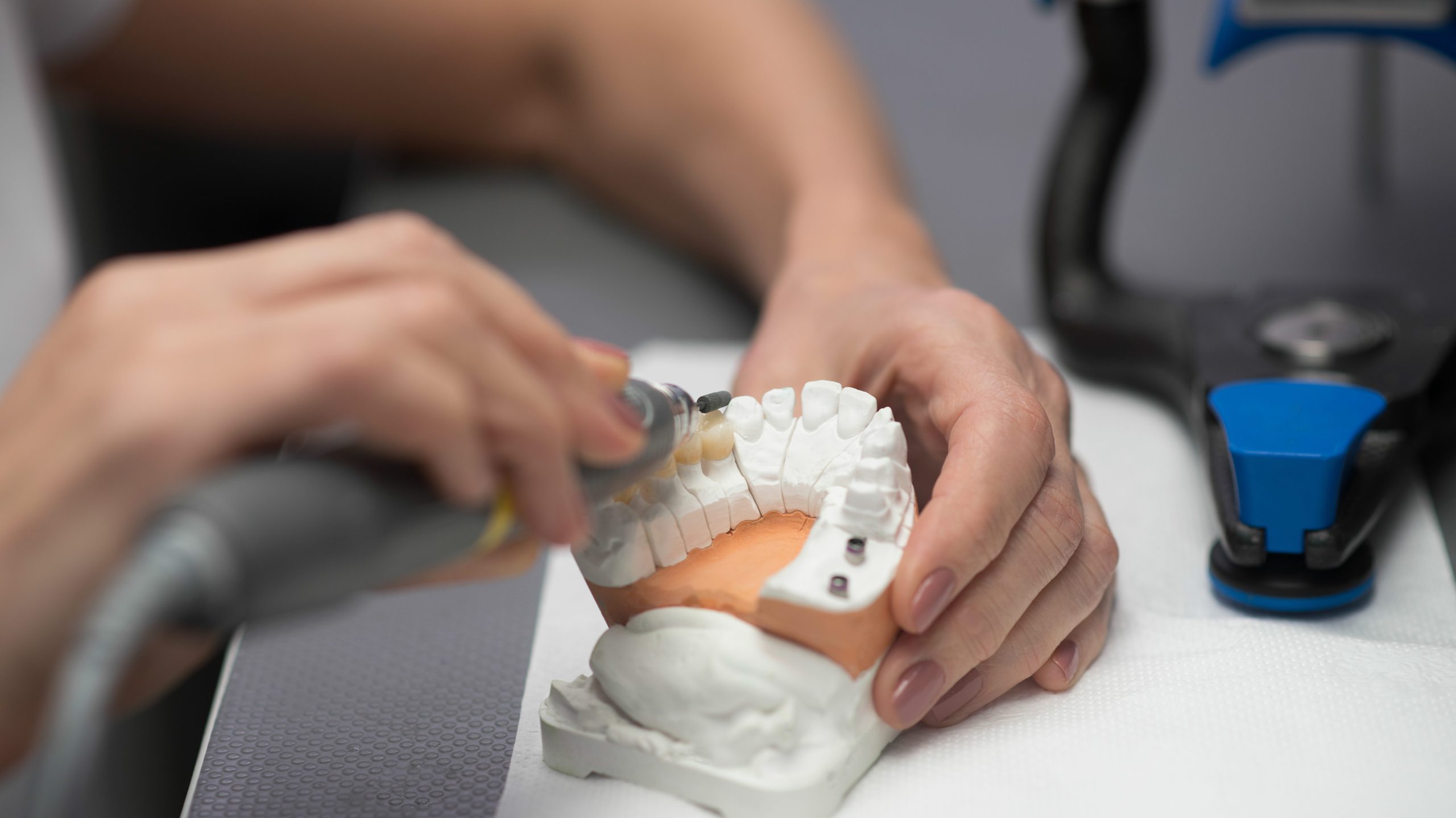 An expert working with plaster prosthesis at the dental office