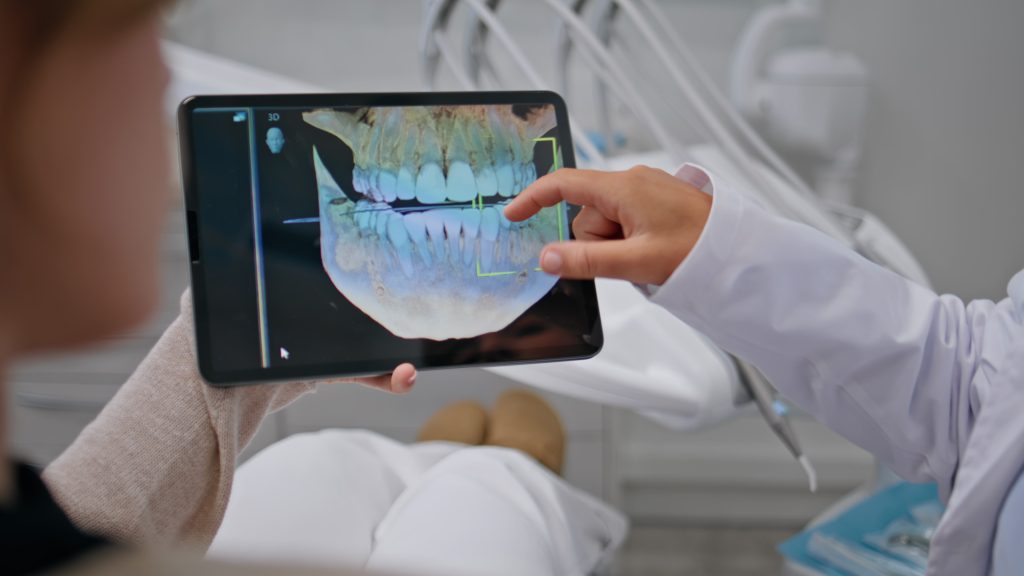Dentist hands holding x-ray on tablet at consultation stomatology clinic closeup