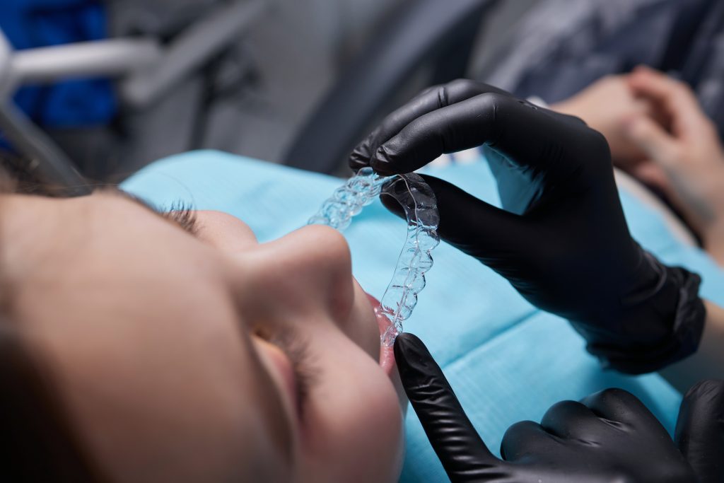 caucasian little kid girl invisible aligner and pointing to her perfect straight teeth. Dental healthcare and confidence concept.