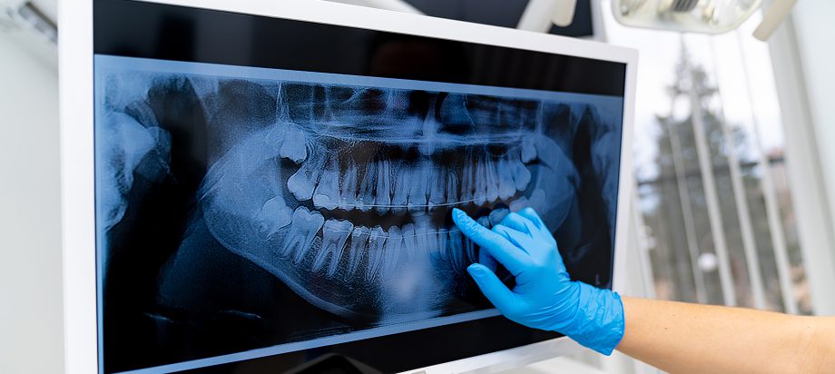 esteticheskaya-stomatologiya-astana-10