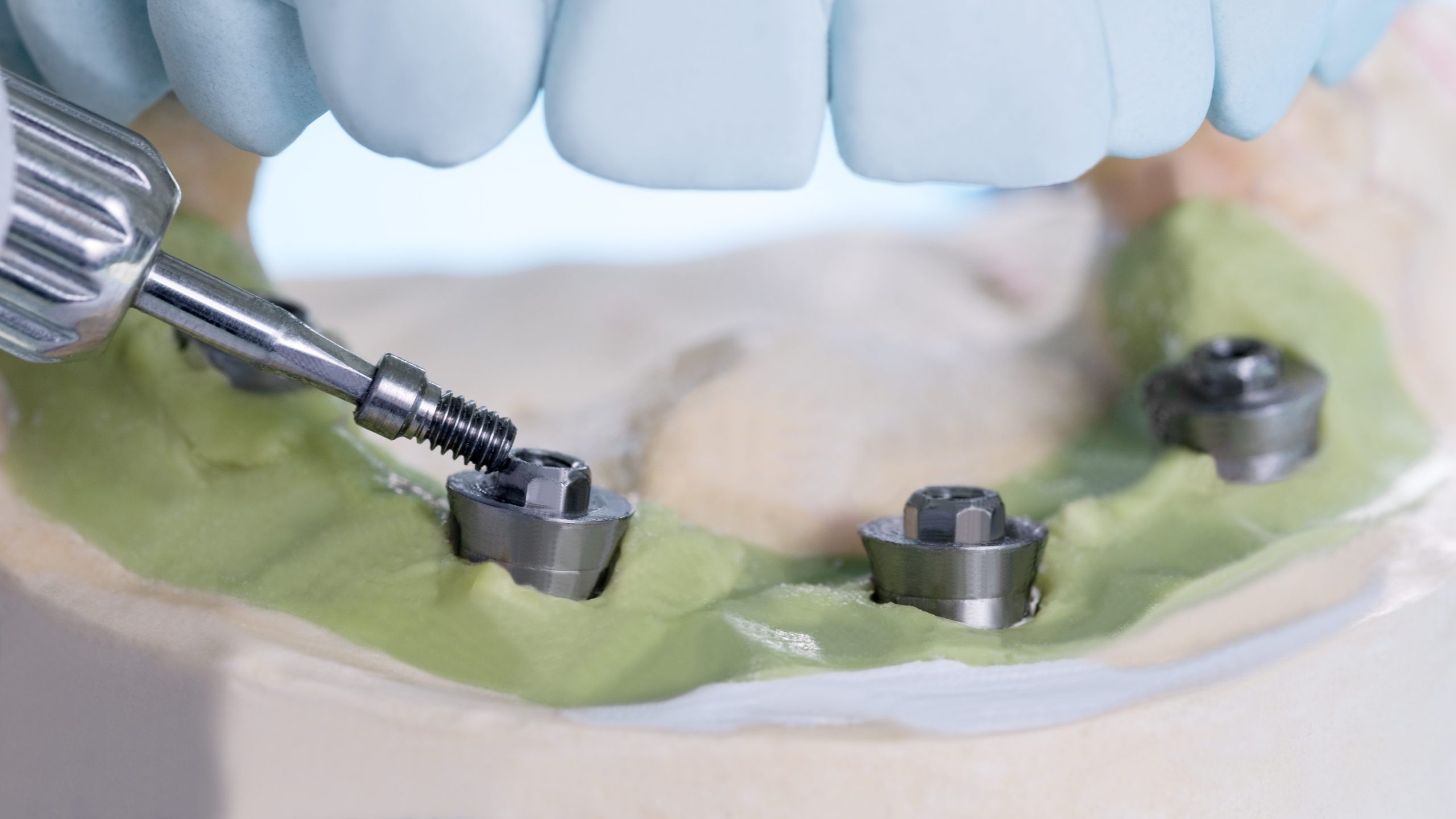 Dental implant temporary abutment