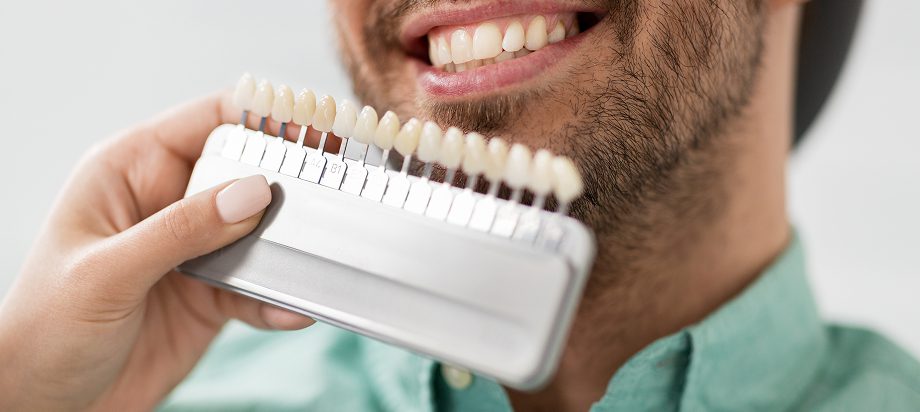 keramicheskie-viniry-astana