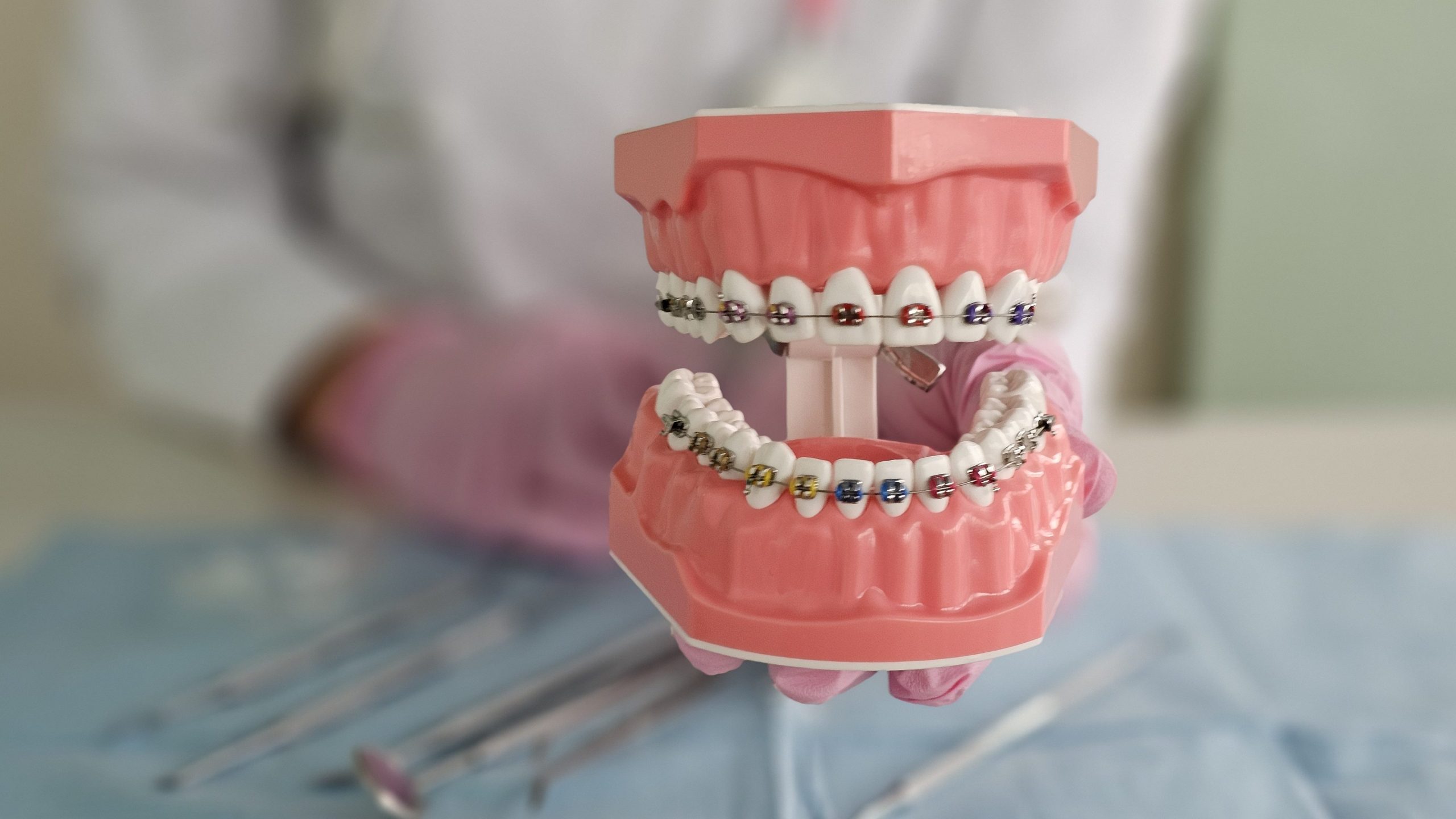 Educational dental model showcasing orthodontic braces on teeth in a dental