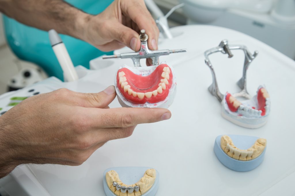 the dentist holds a mock jaw in his hand